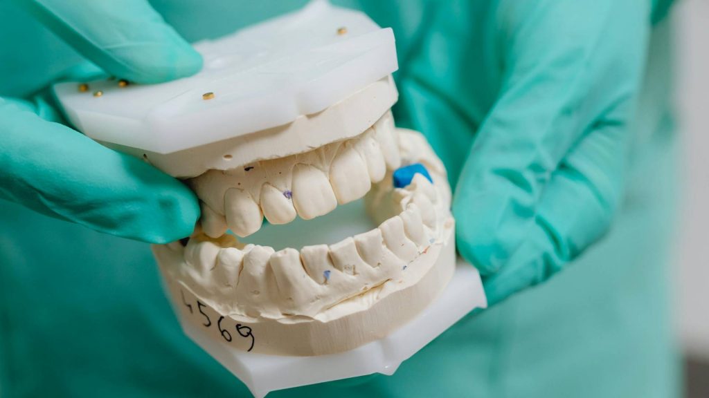 Choisir le bon type de dentier dentimad