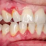 Pourquoi une mauvaise hygiène buccale pose un vrai problème