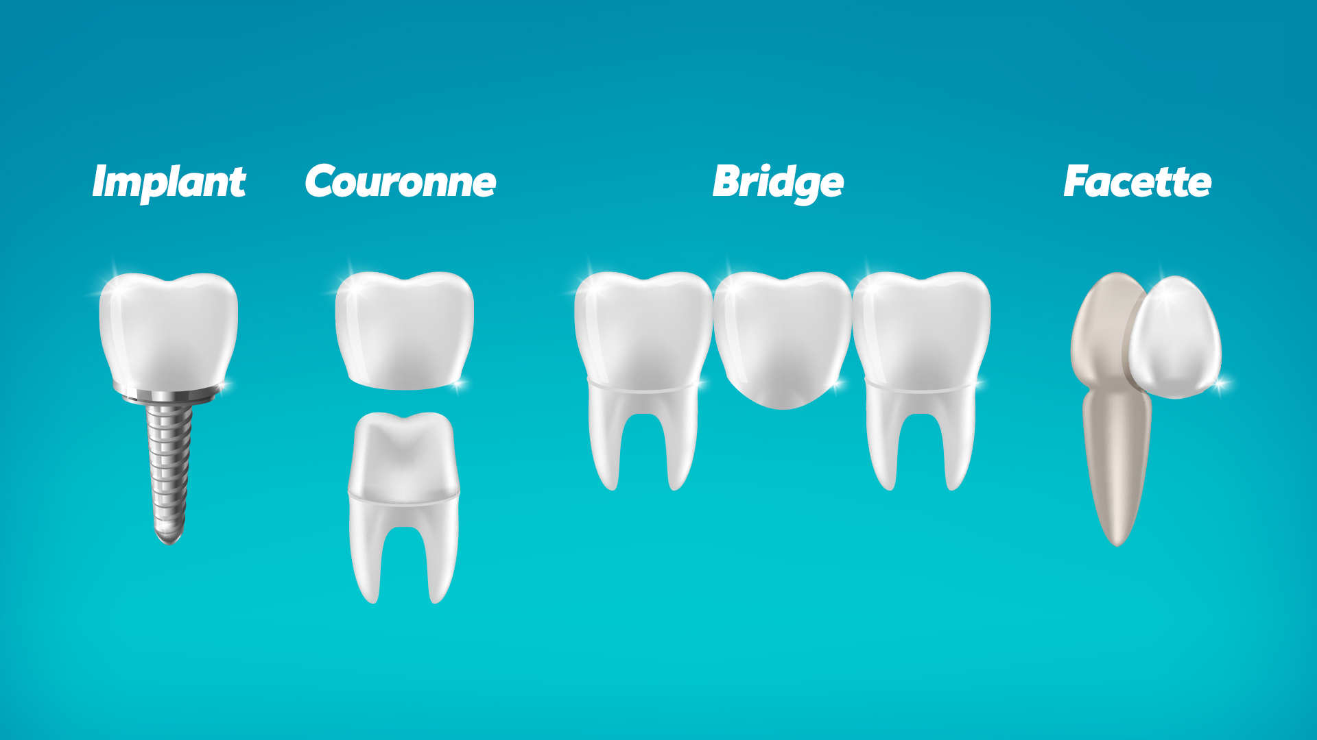 1. Conseils pour choisir la prothèse dentaire adaptée pour chacun