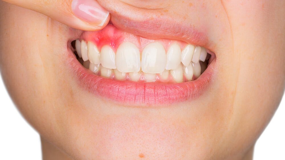 Quels sont les signes d’alerte à ne pas ignorer ?